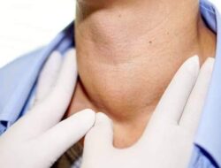 Ini Khasiat Lodine bagi Tubuh, Diantaranya Mencegah Gondok